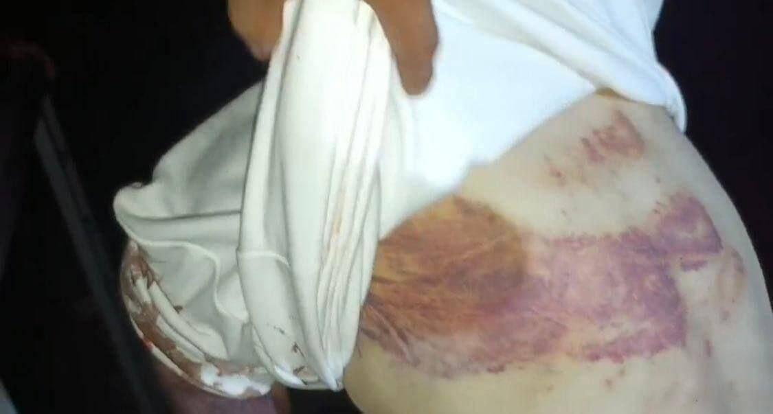 Tortura brutal em cativeiro